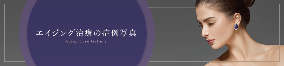 エイジング治療の症例写真