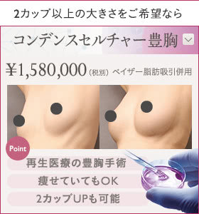 2カップ以上の大きさをご希望なら コンデンスセルチャー豊胸 ¥1,580,000（税込¥1,738,000）ベイザー脂肪吸引併用 | Point: 再生医療の豊胸手術 / 痩せていてもOK / 2カップUPも可能