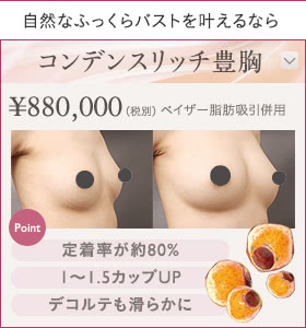 自然なふっくらバストを叶えるなら コンデンスリッチ豊胸 ¥880,000（税込¥968,000）ベイザー脂肪吸引併用 | Point: 定着率が約80% / 1〜1.5カップUP / デコルテも滑らかに