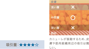 カニューレが振動するため、皮膚や筋肉組織周辺の吸引は難しい。 / 吸引量：★★★★☆