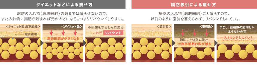 ダイエットなどによる痩せ方: ＜ダイエット前＞ 脂肪細胞 / ＜ダイエット後＞ 脂肪細胞が小さくなる / 不摂生で元に戻る これがリバウンド | 脂肪吸引による痩せ方: ＜吸引前＞ / ＜吸引後＞ 細胞ごと体外に排出=細胞の数が減る / 細胞数の範疇しか太らないのでリバウンドしにくい！ 