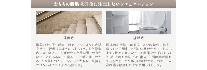 太ももの脂肪吸引ーダウンタイム中の痛みについて