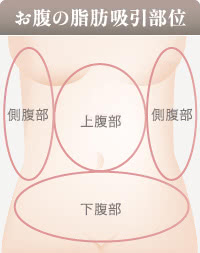 お腹の脂肪吸引の部位の詳細