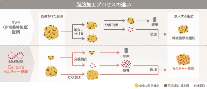 セルチャー豊胸とセリューション豊胸の違い