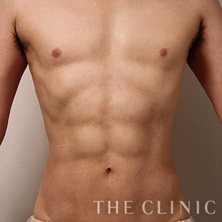 症例写真 / 4Dスカルプト 術後