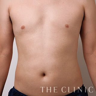 症例写真 / 4Dスカルプト 術前