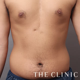 症例写真 / 4Dスカルプト 術前